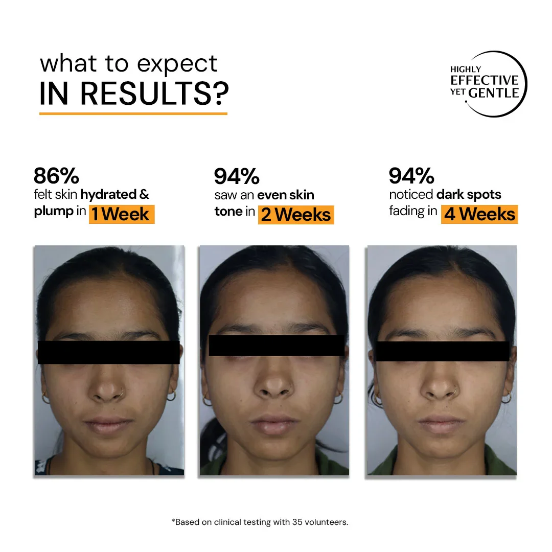 10% Vitamin C Serum for Glowing Skin | Clinically Tested, Non-Irritating| Brightens & Evens Tone  | For Oily Skin - Image 9